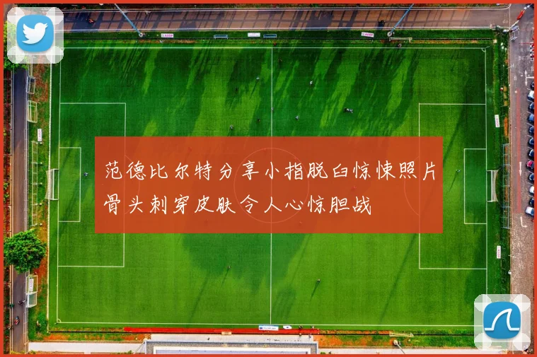 范德比尔特分享小指脱臼惊悚照片骨头刺穿皮肤令人心惊胆战